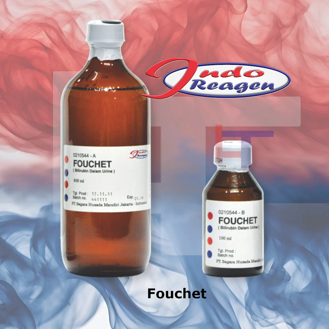 Fouchet Reagen